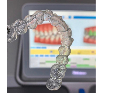 Invisalign Free consultation and digital scanning