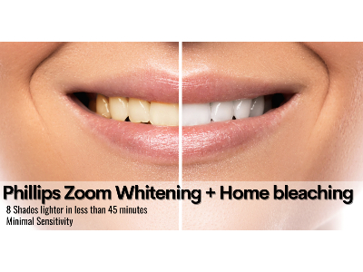 Zoom Whitening + Home Bleaching Kit