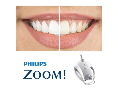 Zoom Whitening 